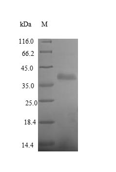 Recombinant Human Receptor-type tyrosine-protein phosphatase beta (PTPRB), partial – Figure 1 of 1
