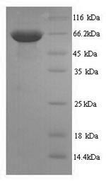 Recombinant Human Receptor-type tyrosine-protein phosphatase C (PTPRC), partial – Figure 1 of 1