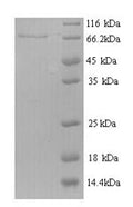 Recombinant Mouse Receptor-type tyrosine-protein phosphatase N2 (Ptprn2), partial – Figure 1 of 1