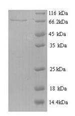 Recombinant Mouse Receptor-type tyrosine-protein phosphatase N2 (Ptprn2), partial – Figure 1 of 1