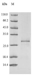 Recombinant Human Receptor-type tyrosine-protein phosphatase zeta (PTPRZ1), partial – Figure 1 of 1