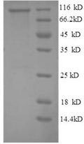 Recombinant Human Glycogen phosphorylase, liver form (PYGL), partial – Figure 1 of 1