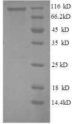 Recombinant Human Glycogen phosphorylase, liver form (PYGL), partial – Figure 1 of 1