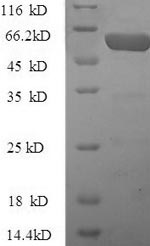 Recombinant Human Pregnancy zone protein (PZP), partial – Figure 1 of 1