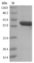 (Tris-Glycine gel) Discontinuous SDS-PAGE (reduced) with 5% enrichment gel and 15% separation gel.