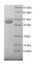 Recombinant Human UV excision repair protein RAD23 homolog A (RAD23A) – Figure 1 of 1