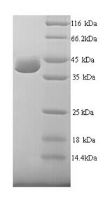 Recombinant Human UV excision repair protein RAD23 homolog A (RAD23A) – Figure 1 of 1
