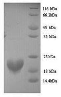 Recombinant Human Putative RNA-binding protein 3 (RBM3) – Figure 1 of 1