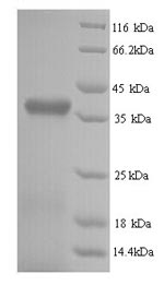 Recombinant Bovine Retinol-binding protein 3 (RBP3), partial – Figure 1 of 1