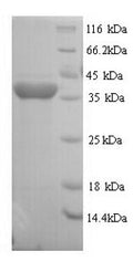Recombinant Rat Regucalcin (Rgn) – Figure 1 of 1