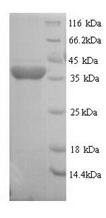 Recombinant Rat Regucalcin (Rgn) – Figure 1 of 1