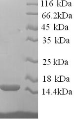 Recombinant Human RING-box protein 2 (RNF7) – Figure 1 of 1