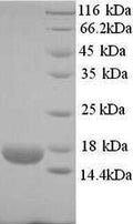 Recombinant Human Ropporin-1B (ROPN1B) – Figure 1 of 1