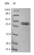 Recombinant Human Inactive tyrosine-protein kinase transmembrane receptor ROR1 (ROR1), partial – Figure 1 of 1