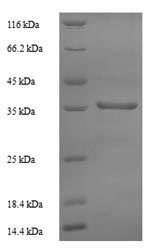 Recombinant Human 60S acidic ribosomal protein P0 (RPLP0) – Figure 1 of 1