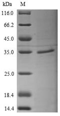 (Tris-Glycine gel) Discontinuous SDS-PAGE (reduced) with 5% enrichment gel and 15% separation gel.