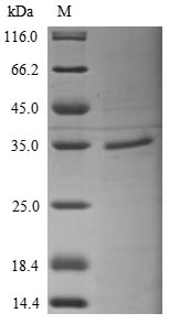 (Tris-Glycine gel) Discontinuous SDS-PAGE (reduced) with 5% enrichment gel and 15% separation gel.