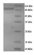 Recombinant Human Ribonucleoside-diphosphate reductase large subunit (RRM1) – Figure 1 of 1