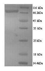 Recombinant Human Ribonucleoside-diphosphate reductase large subunit (RRM1) – Figure 1 of 1