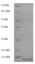 Recombinant Cat Serum amyloid A protein (SAA1), partial – Figure 1 of 1