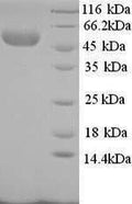 Recombinant Rabbit E-selectin (SELE), partial – Figure 1 of 1