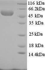 Recombinant Rabbit E-selectin (SELE), partial – Figure 1 of 1