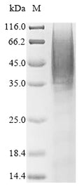 Recombinant Human Selenoprotein P (SELENOP) (U59S,U300S,U318S,U330S,U345S,U352S,U367S,U369S,U376S,U378S) – Figure 1 of 1