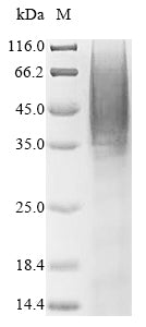 Recombinant Human Selenoprotein P (SELENOP) (U59S,U300S,U318S,U330S,U345S,U352S,U367S,U369S,U376S,U378S) – Figure 1 of 1