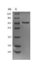 Recombinant Rat Alpha-1-antiproteinase (Serpina1) – Figure 1 of 1