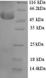 Recombinant Human Corticosteroid-binding globulin (SERPINA6) – Figure 1 of 1