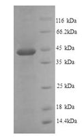 Recombinant Mouse Plasminogen activator inhibitor 1 (Serpine1) – Figure 1 of 1