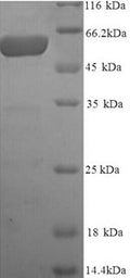 Recombinant Human Melanocyte protein PMEL (PMEL), partial – Figure 1 of 1