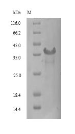 (Tris-Glycine gel) Discontinuous SDS-PAGE (reduced) with 5% enrichment gel and 15% separation gel.