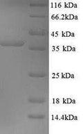 Recombinant Mouse Excitatory amino acid transporter 2 (Slc1a2), partial – Figure 1 of 1