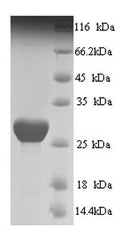 Recombinant Human Prestin (SLC26A5), partial – Figure 1 of 1