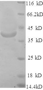 Recombinant Human Long-chain fatty acid transport protein 2 (SLC27A2), partial – Figure 1 of 1