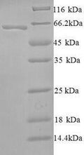 Recombinant Human Probable global transcription activator SNF2L2 (SMARCA2), partial – Figure 1 of 1