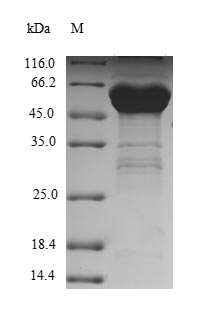 Recombinant Human Transcription activator BRG1 (SMARCA4), partial – Figure 1 of 1