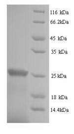 Recombinant Human Suppressor of cytokine signaling 1 (SOCS1) – Figure 1 of 1