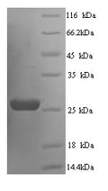 Recombinant Rat Suppressor of cytokine signaling 3 (Socs3) – Figure 1 of 1