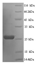Recombinant Rat Suppressor of cytokine signaling 3 (Socs3) – Figure 1 of 1