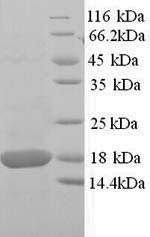 Recombinant Mouse Superoxide dismutase [Cu-Zn] (Sod1) – Figure 1 of 1