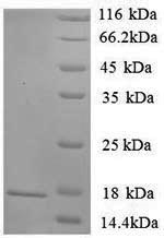 Recombinant Rat Sortilin (Sort1), partial – Figure 1 of 1