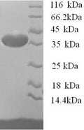 Recombinant Mouse Osteopontin (Spp1), partial – Figure 1 of 1