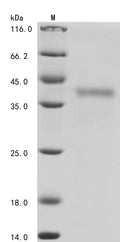 (Tris-Glycine gel) Discontinuous SDS-PAGE (reduced) with 5% enrichment gel and 15% separation gel.