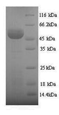 Recombinant Human Sulfite oxidase, mitochondrial (SUOX) – Figure 1 of 1
