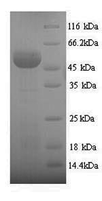 Recombinant Human Sulfite oxidase, mitochondrial (SUOX) – Figure 1 of 1