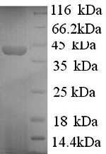 Recombinant Human Synapsin-1 (SYN1), partial – Figure 1 of 1