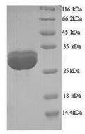Recombinant Saccharomyces cerevisiae TATA-box-binding protein (SPT15) – Figure 1 of 1