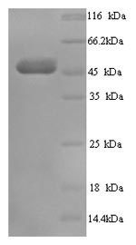 Recombinant Human Transcobalamin-1 (TCN1) – Figure 1 of 1